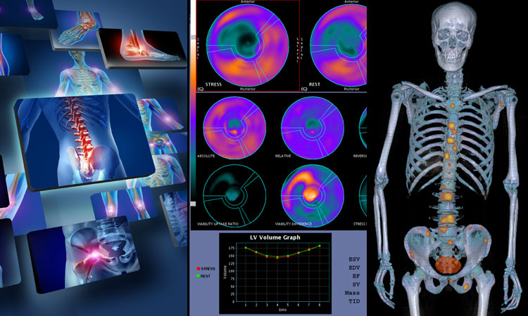 scintigrafia-guidonia-roma-tivoli