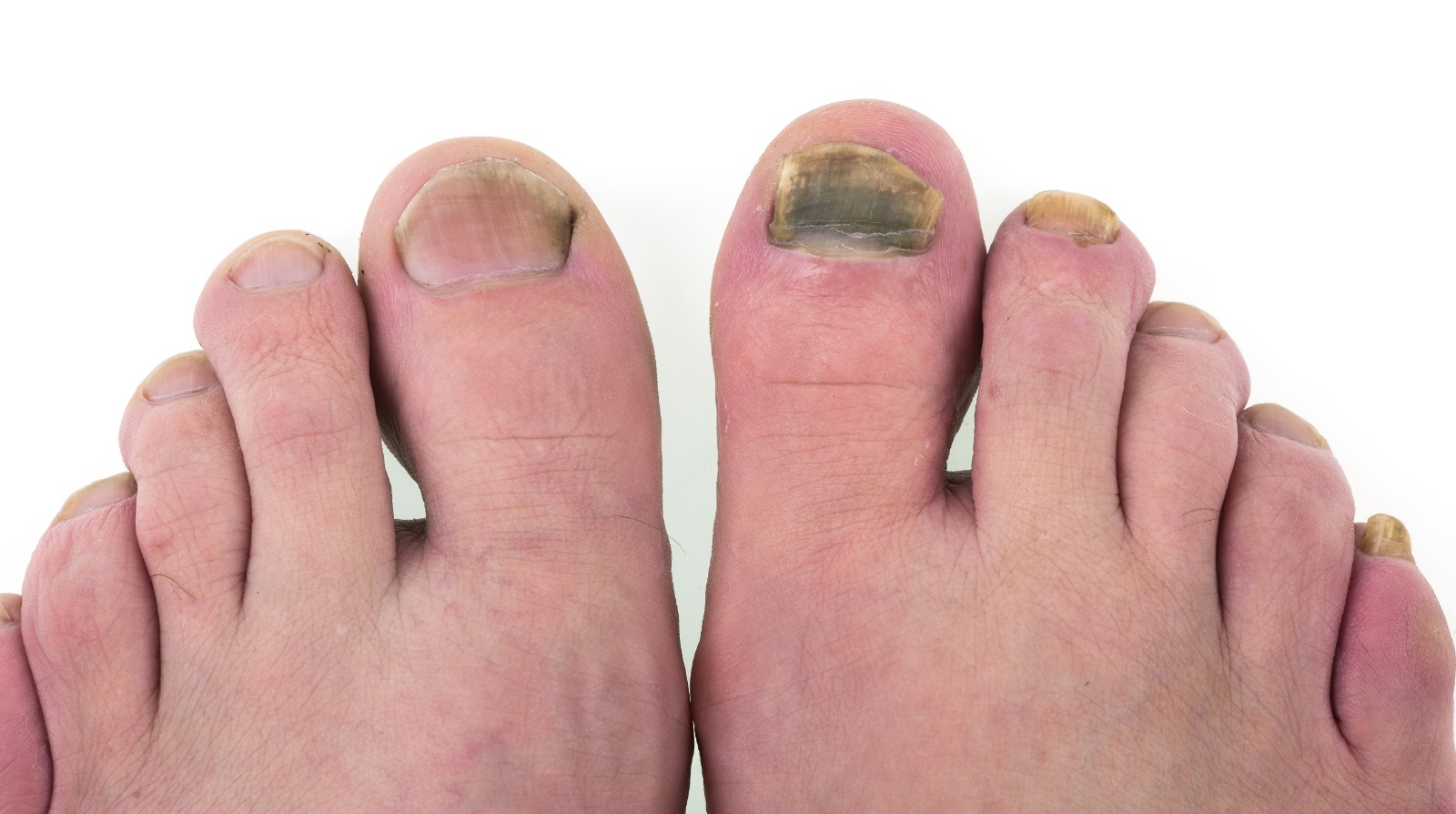 8576c28f-1723-4a61-a29e-94e802f37a31