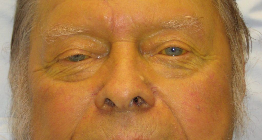 Ittero: cos’è, da cosa è causato e quando preoccuparsi