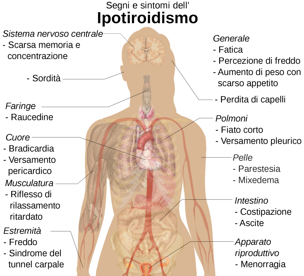 Galleria foto - Ipotiroidismo: cause, sintomi, dieta e terapie utili per ripristinare la tiroide Foto 1