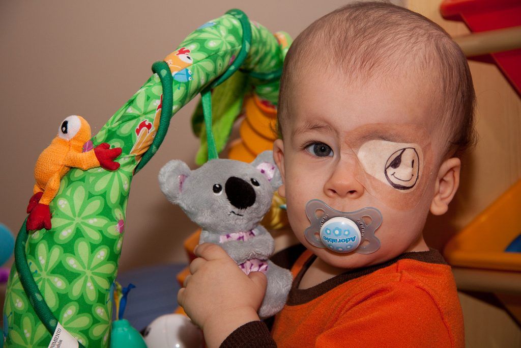 Ambliopia: cause, sintomi e trattamenti per l’occhio pigro