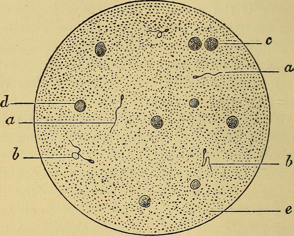 Azoospermia, cos’è, diagnosi e trattamenti di questo problema maschile