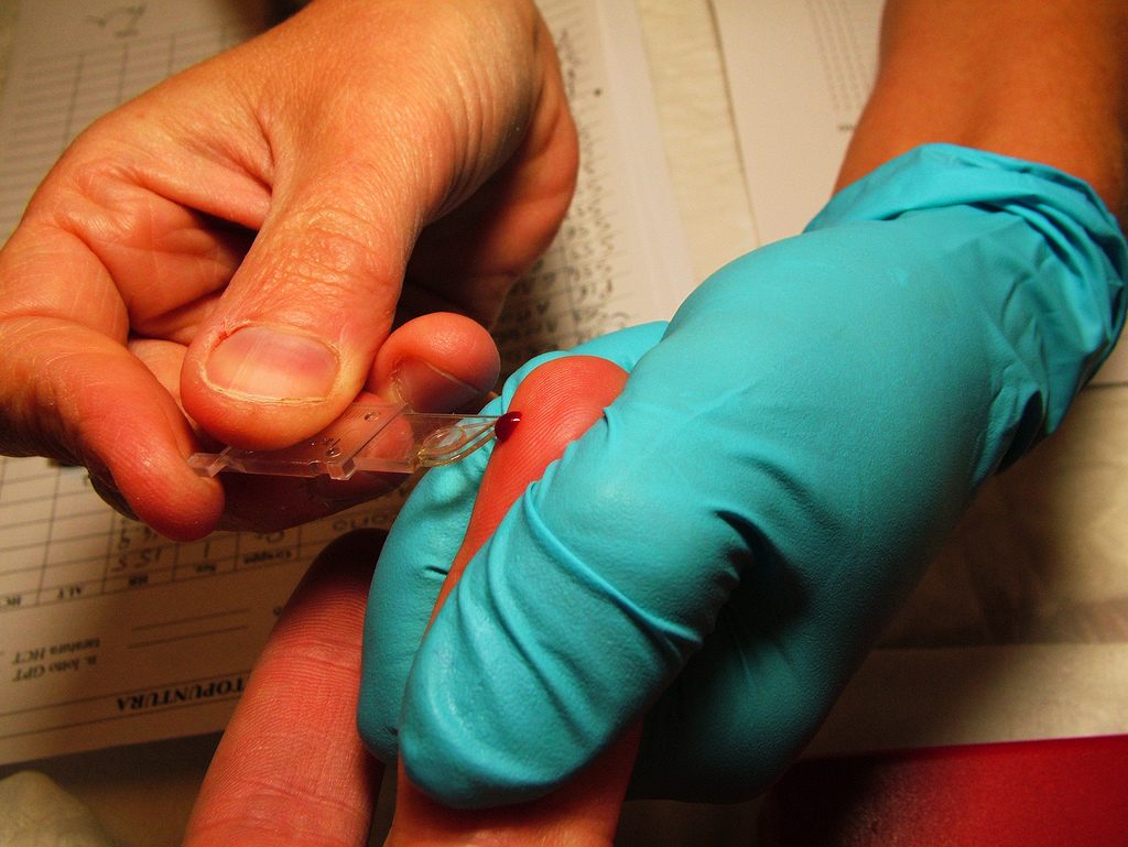 Emoglobina: funzioni e alterazioni di livello di questa sostanza