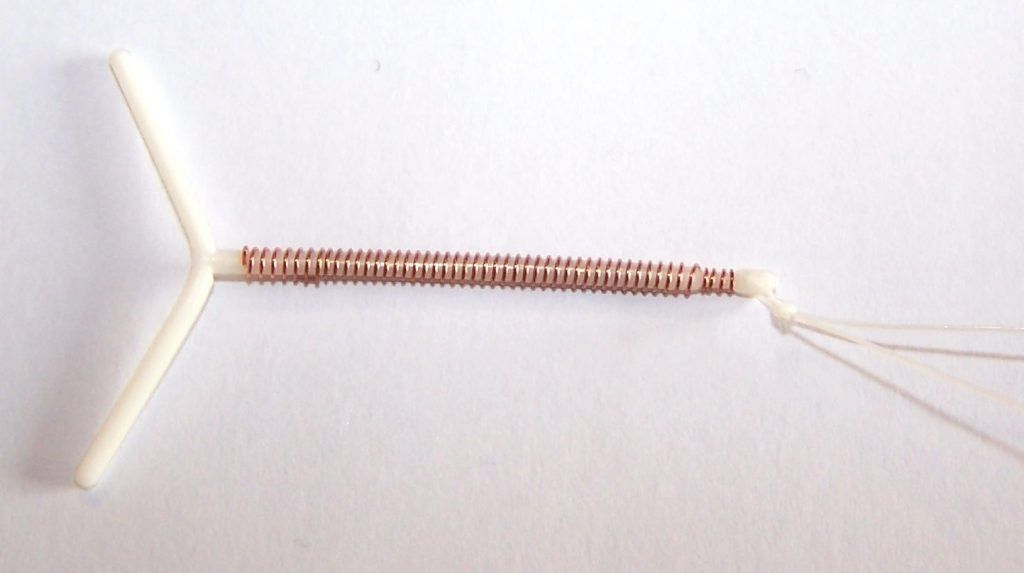 Spirale Anticoncezionale: come usarla, costo e controindicazioni