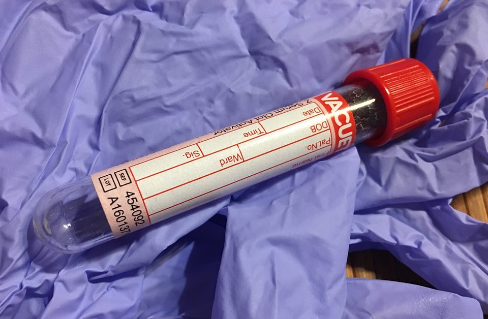 Fosfatasi Alcalina alta o bassa: cos’è e quando preoccuparsi